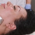 Benefits Of Visiting A Wellness Center Than Beauty Salon For Skin Rejuvenation In Stamford, CT